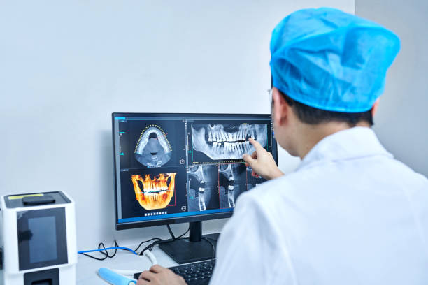Best Emergency Treatment for Dental Infections or Abscesses in Schuylerville, NY